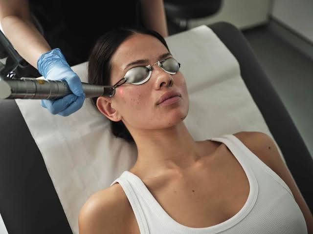 Q-Switch Treatment Laser